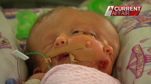 Onlar hayatta kalan tek ikizler - Resim: 1