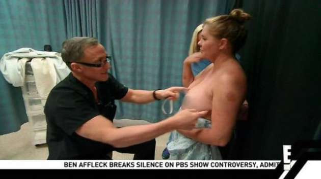 Canlı yayında göğüs estetiği - Resim: 2