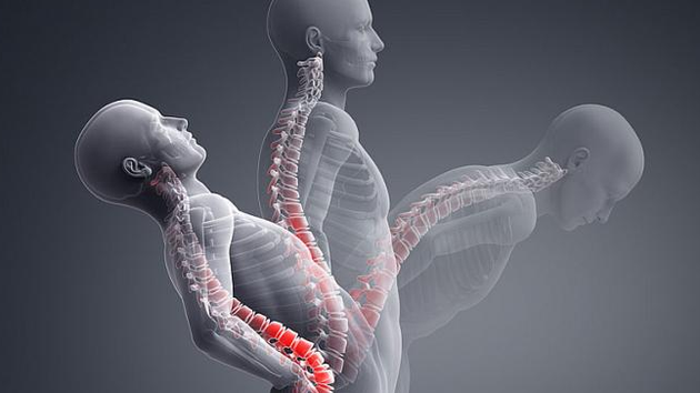 Bel fıtığına sebep olan 4 neden aman bunlardan uzak durun! - Resim: 1