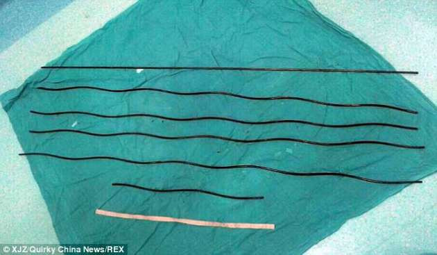 Boğazına 6 demir çubuk saplandı - Resim: 3