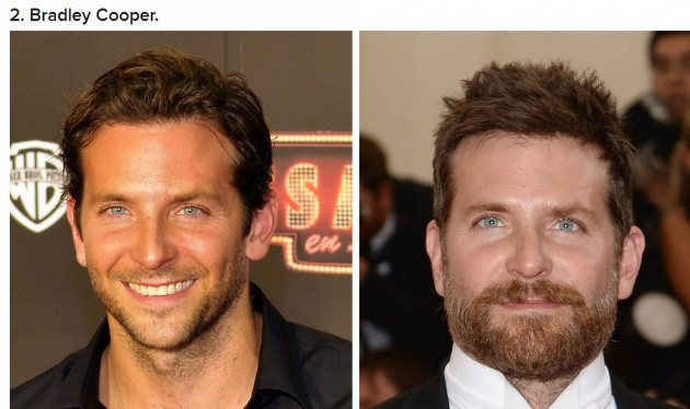 5 yılda inanılmaz değiştiler - Resim: 2