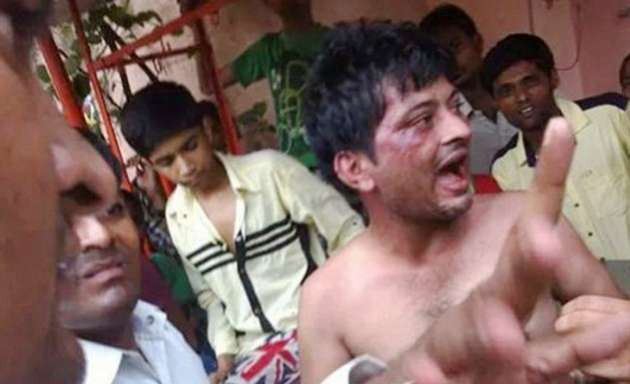 Tecavüzcüyü yakalayıp penisini kestiler - Resim: 2