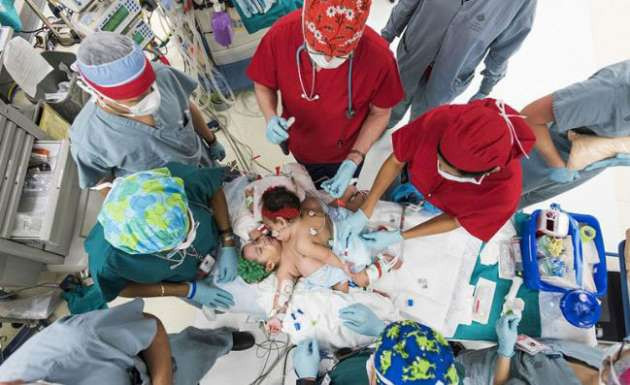 ABD'de yapışık ikizler ameliyatla ayrıldı - Resim: 2