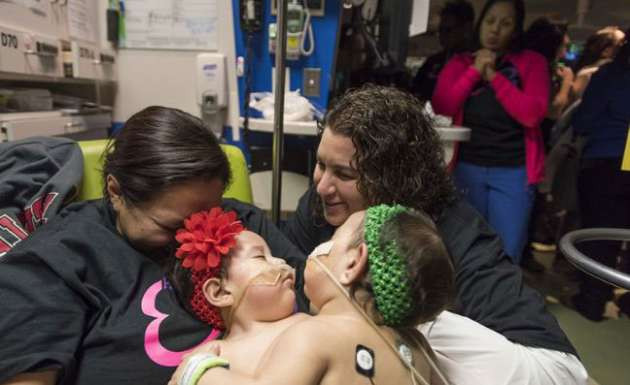 ABD'de yapışık ikizler ameliyatla ayrıldı - Resim: 3