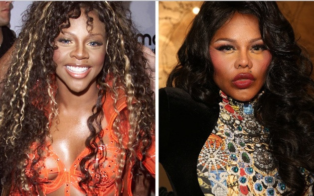 Estetik olup eski yüzlerini bile unutanlar - Resim: 2