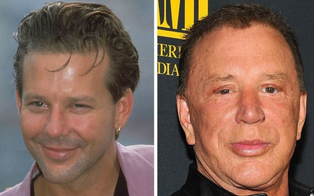 Estetik olup eski yüzlerini bile unutanlar - Resim: 4