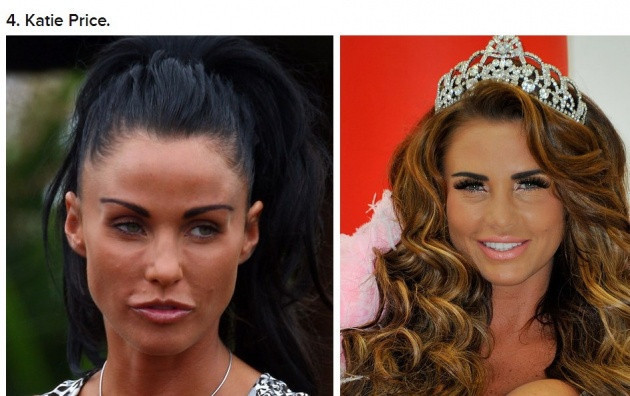 5 yılda inanılmaz değiştiler - Resim: 4