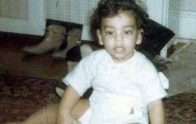 Estetik yaptırayım dedi bu hale geldi sonu ise daha beter - Resim: 3