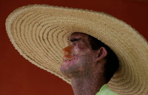 Bu köyde yaşayan herkes eriyor - Resim: 2