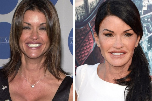 Estetik olup eski yüzlerini bile unutanlar - Resim: 3