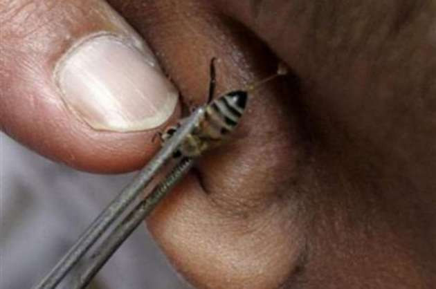 Satırla tedavi ediyorlar, idrar içip sağlıklı kalıyorlar! - Resim: 3