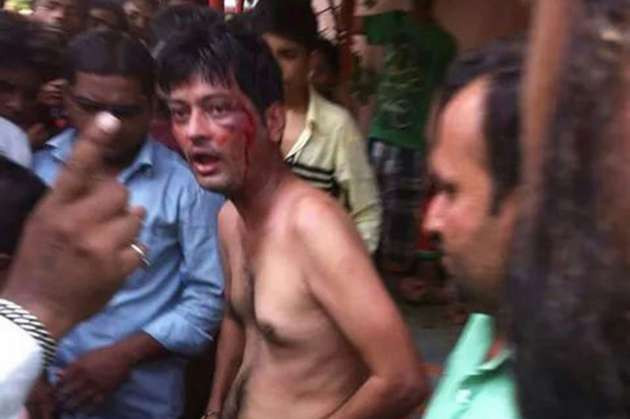 Tecavüzcüyü yakalayıp penisini kestiler - Resim: 1