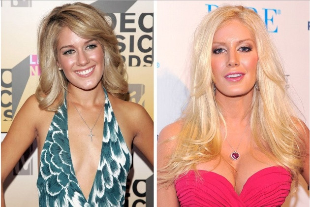 Estetik olup eski yüzlerini bile unutanlar - Resim: 1