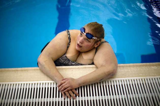 Günde 300 kez orgazm oluyor - Resim: 1