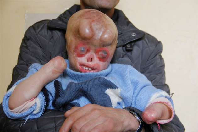 Talihsiz çocuk sokağa çıkamıyor - Resim: 1