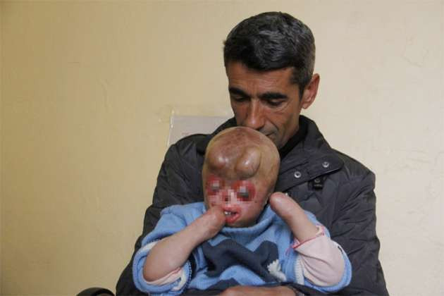 Talihsiz çocuk sokağa çıkamıyor - Resim: 2