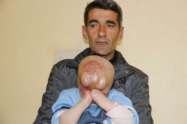 Talihsiz çocuk sokağa çıkamıyor - Resim: 3