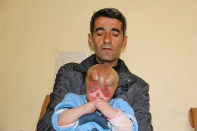 Talihsiz çocuk sokağa çıkamıyor - Resim: 4