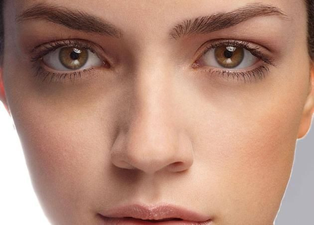 Göz altı morlukları neden oluşur ve nasıl giderilir? - Resim: 1