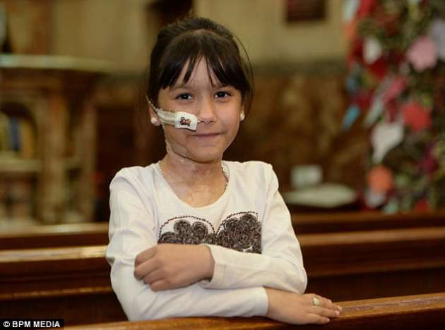 Penisilin alerjisi iç organlarını yaktı - Resim: 1