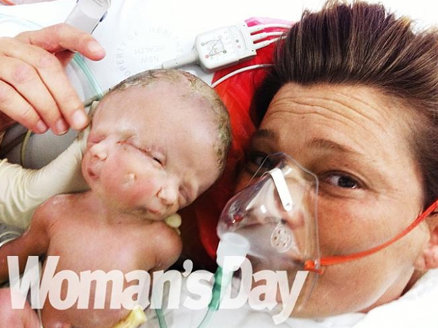 Onlar hayatta kalan tek ikizler - Resim: 2