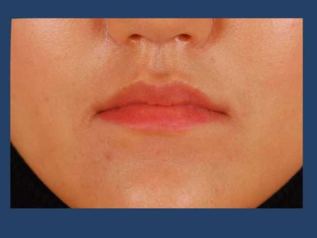 Kore'de estetik çılgınlığı - Resim: 3