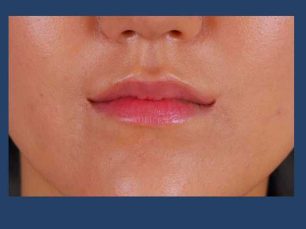 Kore'de estetik çılgınlığı - Resim: 4