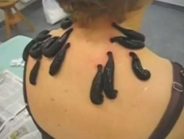 Satırla tedavi ediyorlar, idrar içip sağlıklı kalıyorlar! - Resim: 4