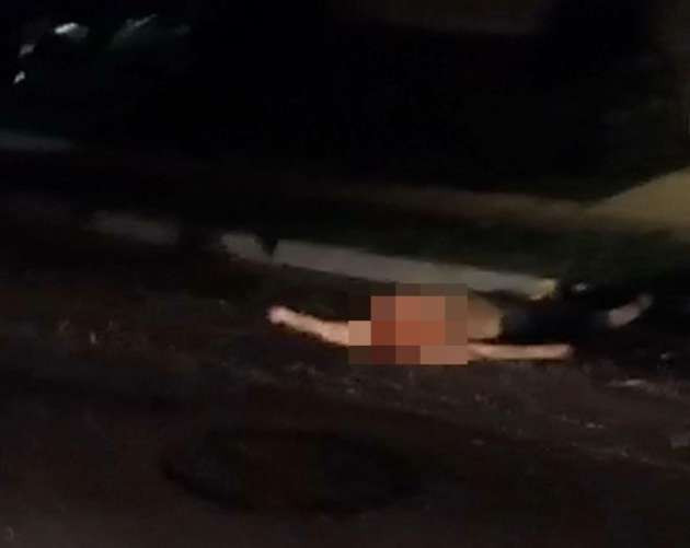 Annesinin kafasını kesti şaka zannettiler - Resim: 1