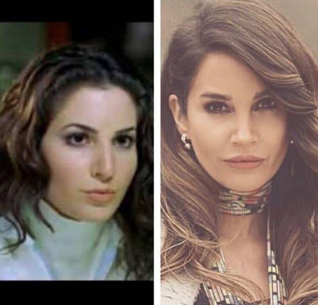 Seks sahnesi olay olmuştu! Meğer Rojda Demirer estetik harikasıymış   - Resim: 4