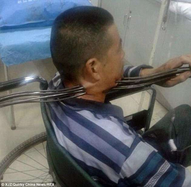 Boğazına 6 demir çubuk saplandı - Resim: 1