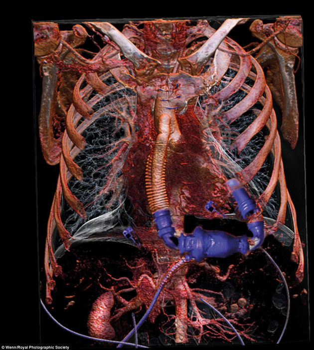 Sizi şok edecek gerçek fotoğaflar - Resim: 2