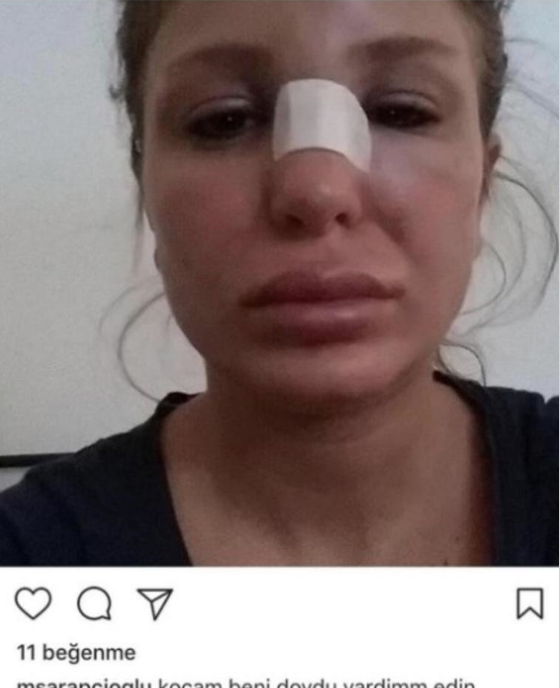 Berk Oktay'ın çıplak fotoğraflarını sızdır mı işte ilk açıklama! - Resim: 2