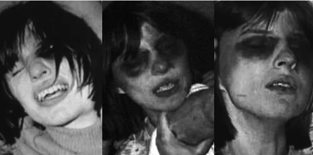 Onu ailesi bu hale getirdi gerçekler tüyler ürpetti - Resim: 4