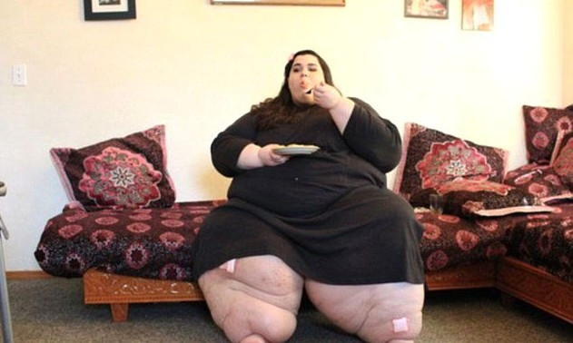 Ölmesi beklenirken tam 120 kilo verdi! Mucizeye bakın... - Resim: 1