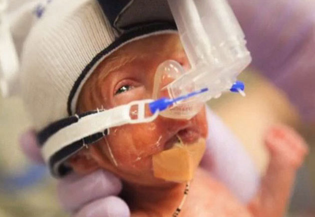 İşte onların ilk anları... - Resim: 4