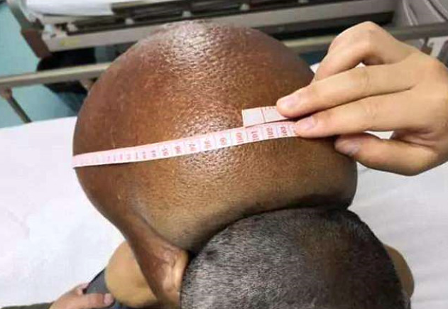 Boynunu görenler korkup kaçıyordu tam 15 kilo! - Resim: 4