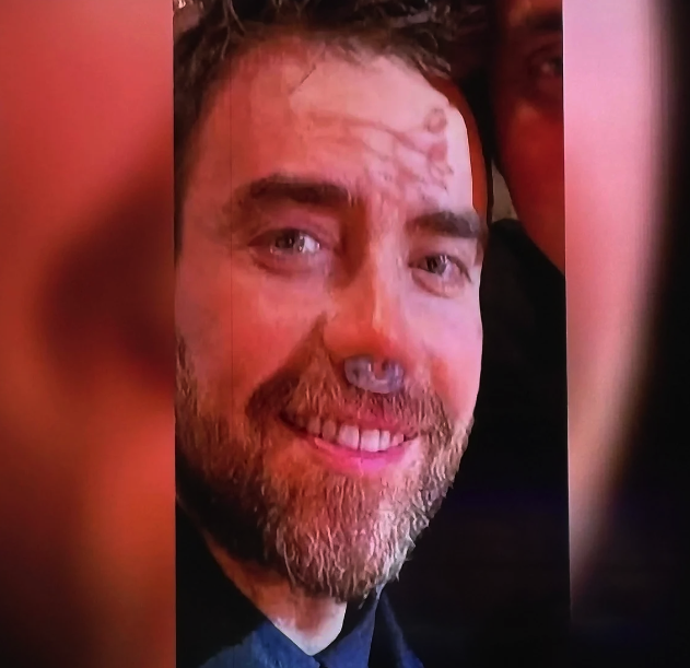 Murat Dalkılıç 12. kez bıçak altında! Ameliyattan sonraki o hali içler acısı... - Resim: 4