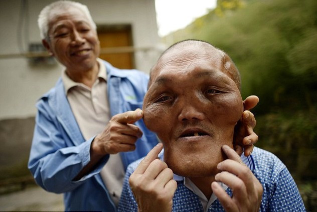 Milyonda bir görülen hastalık bağış toplayamazsa... - Resim: 4