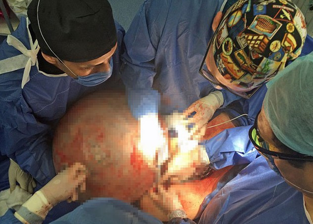 Doktorlar kadının karnını görünce inanamadı - Resim: 3