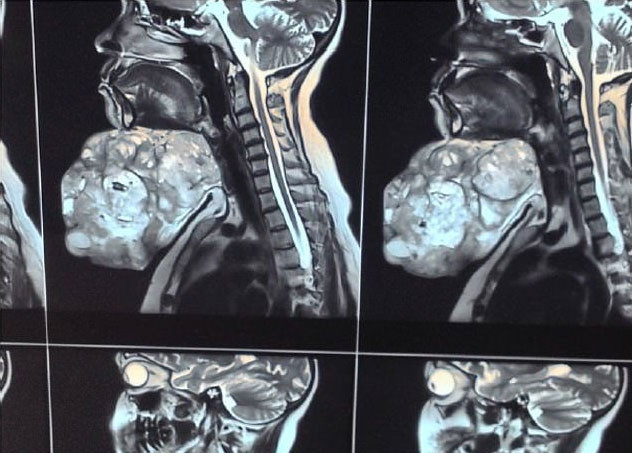 İnanılmaz değişim ikisi de aynı kadın - Resim: 3