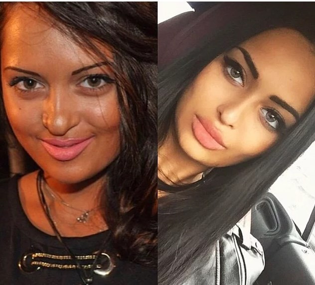 Fenomen olmak için estetik yaptırıyorlar - Resim: 2