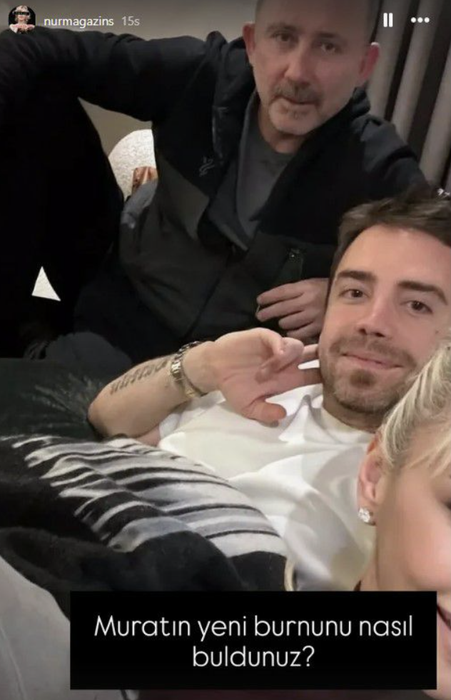 Murat Dalkılıç sağlığına kavuştuktan sonra paylaştı! "2 yıl sonra burnum var" - Resim: 4