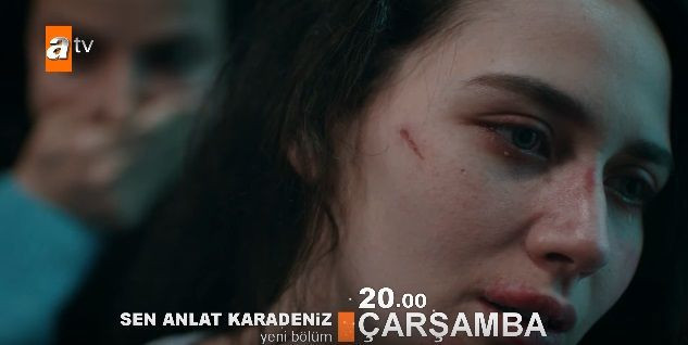 Sen Anlat Karadeniz'i yerden yere vurdular böylesi gerçek rezalet! - Resim: 2