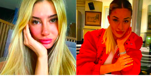 Ayça Çağla Altunkaya yaşı kaç Acun ile sevgilisi yaş farkı kaç? - Resim: 0