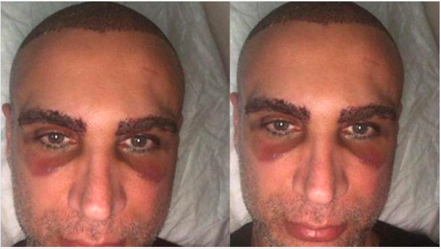 Şarkıcı Doğuş'u gören kaza geçirmiş sandı! Son hali tanınmaz halde  - Resim: 3