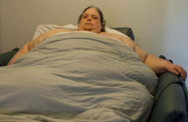 30 yaşına kadar yaşamazsın denilince...  - Resim: 3