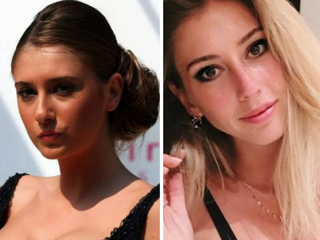 Şeyma Subaşı estetik operasyonlarına bir yenisini daha ekledi! Bu sefer de kalçasına... - Resim: 1