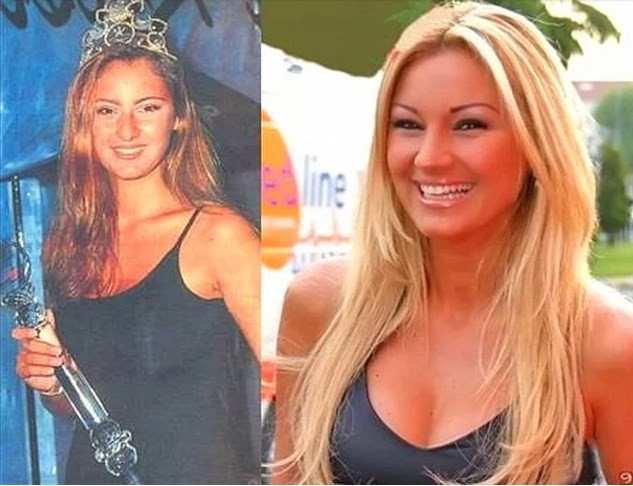 Estetik harikası ünlülerimiz - Resim: 2