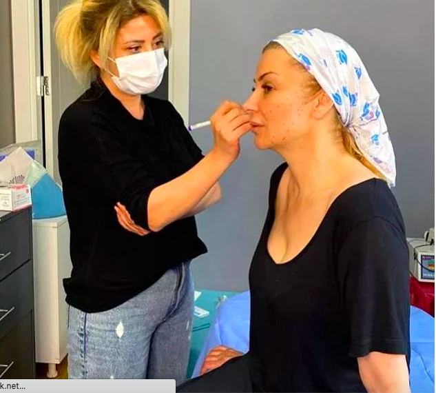 Gören bu Songül Karlı mı dedi! Estetik yaptırdı bambaşka yüzü oldu - Resim: 3